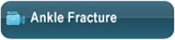 Ankle Fracture